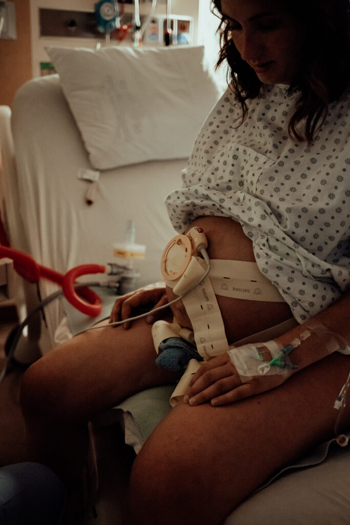 External monitoring used during a hospital birth.